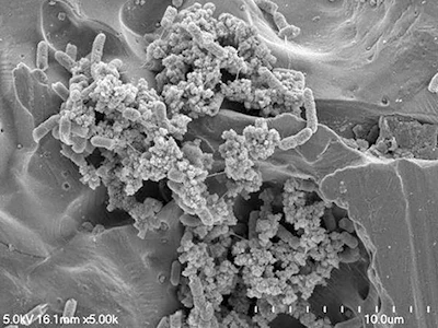 Salmonella biofilm on stainless steel surface. Photo courtesy of You Zhou (UNL) and Rong Wang (ARS)