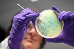 Bacteria Listeria I Stock 1190512184
