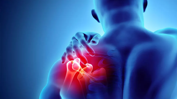 The Cost Of Workplace Injuries In Manufacturing
