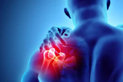 The Cost Of Workplace Injuries In Manufacturing