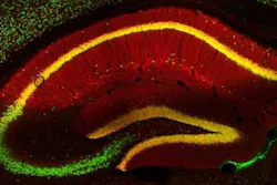 Nerve cells of a mouse brain (green) and the protein PRG-1 (red). If the nerve cells contain PRG-1, the cells appear in yellow.