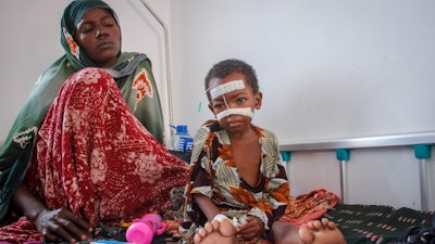 Kalson Hussein, 4, sits next to her mother, Isho Shukria, 35, at the Martini hospital, Mogadishu, Sept. 3, 2022.