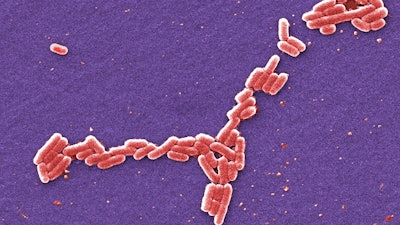 This colorized 2006 scanning electron microscope image made available by the Centers for Disease Control and Prevention shows E. coli bacteria of the O157:H7 strain that produces a powerful toxin which can cause illness. At least a dozen people in California and Washington have been sickened with E. coli food poisoning linked to organic walnuts sold in bulk in 19 states, U.S. health officials said Tuesday, April 30, 2024. Stores included chains such as Whole Foods and Market of Choice.