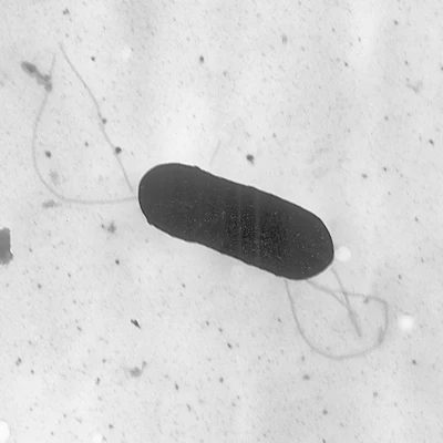 A Listeria monocytogenes bacterium.