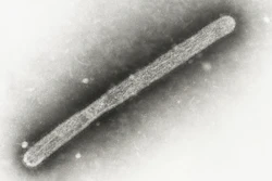 This 2005 electron microscope image shows an avian influenza A H5N1 virion. The Centers for Disease Control and Prevention on Tuesday, July 30, 2024, announced it will spend $5 million to buy seasonal flu shots for livestock workers.