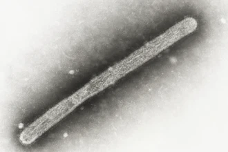 A 2005 electron microscope image of an avian influenza A H5N1 virion.