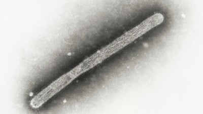 A 2005 electron microscope image of an avian influenza A H5N1 virion.