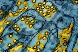 Colorized electron microscope image of avian influenza A H5N1 virus particles (yellow).