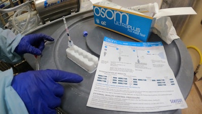 A rapid antigen test on milk from a dairy cow at the National Animal Disease Center research facility, Ames, Iowa, July 29, 2024.