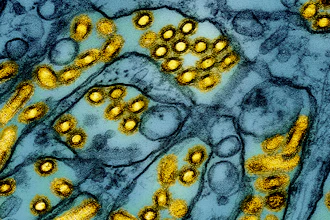 Colorized electron microscope image of avian influenza A H5N1 virus particles (yellow).
