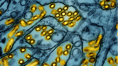 Colorized electron microscope image of avian influenza A H5N1 virus particles (yellow).