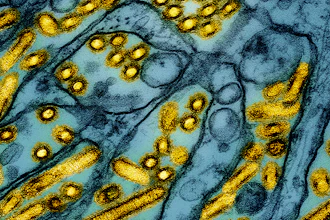 Avian influenza A H5N1 virus particles (yellow) on March 26, 2024