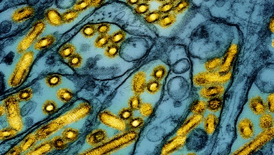 Avian influenza A H5N1 virus particles (yellow) on March 26, 2024