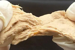 Fusarium venenatum
