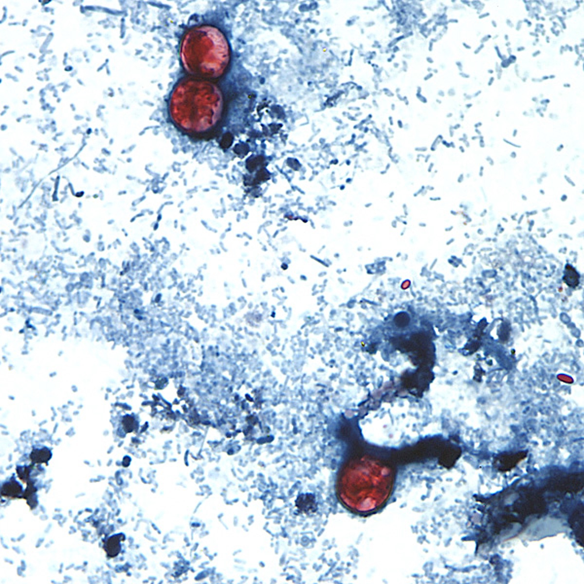 An undated photo taken through a microscope shows Cyclospora cayetanensis oocysts.