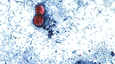 An undated photo taken through a microscope shows Cyclospora cayetanensis oocysts.