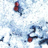 An undated photo taken through a microscope shows Cyclospora cayetanensis oocysts.