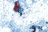 An undated photo taken through a microscope shows Cyclospora cayetanensis oocysts.