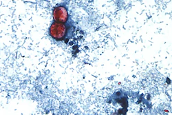An undated photo taken through a microscope shows Cyclospora cayetanensis oocysts.