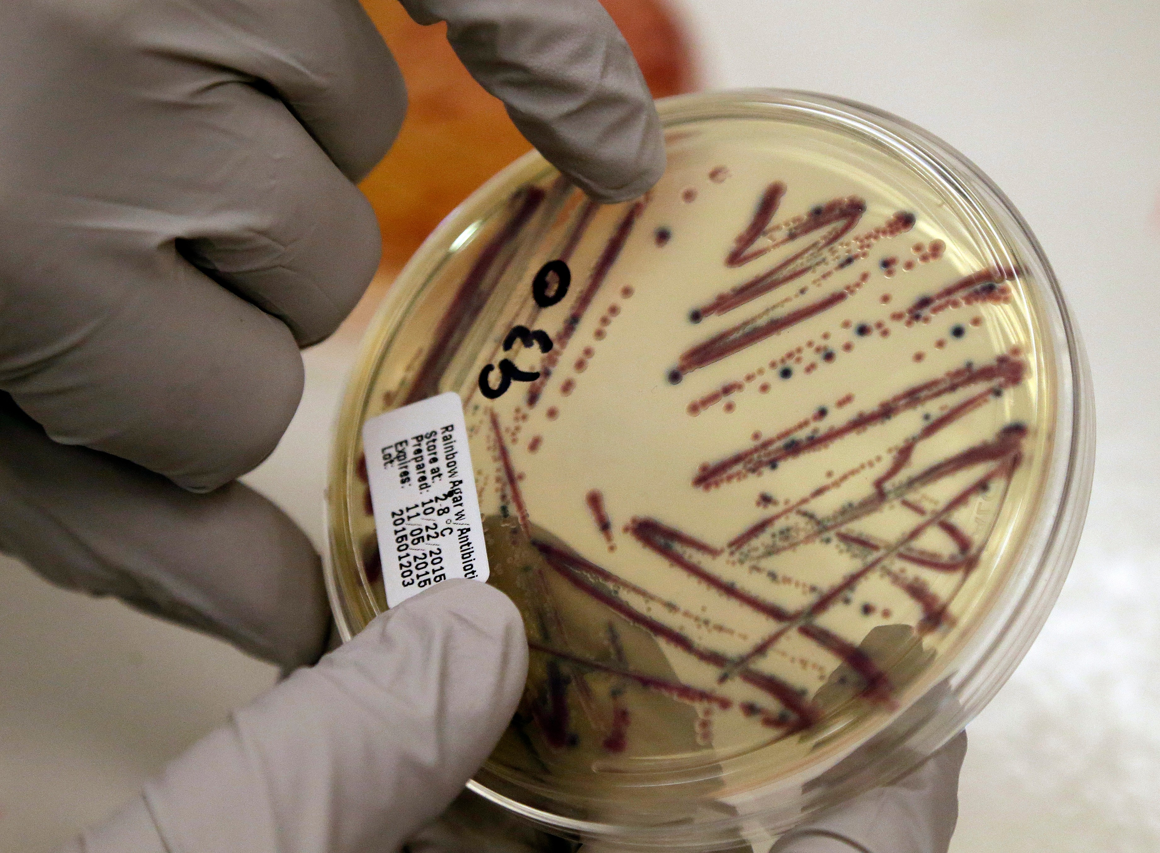 A microbiologist points out an isolated E. coli growth on an agar plate at the Washington State Department of Health, Nov. 3, 2015, Shoreline, Wash.