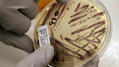 A microbiologist points out an isolated E. coli growth on an agar plate at the Washington State Department of Health, Nov. 3, 2015, Shoreline, Wash.