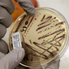 A microbiologist points out an isolated E. coli growth on an agar plate at the Washington State Department of Health, Nov. 3, 2015, Shoreline, Wash.