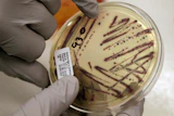 A microbiologist points out an isolated E. coli growth on an agar plate at the Washington State Department of Health, Nov. 3, 2015, Shoreline, Wash.