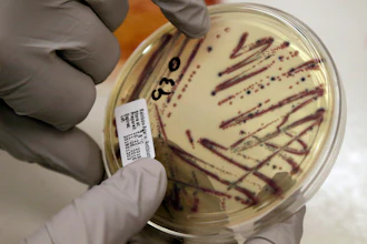 A microbiologist points out an isolated E. coli growth on an agar plate at the Washington State Department of Health, Nov. 3, 2015, Shoreline, Wash.