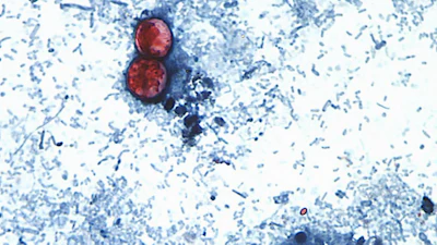 An undated photo taken through a microscope shows Cyclospora cayetanensis oocysts.