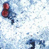 An undated photo taken through a microscope shows Cyclospora cayetanensis oocysts.