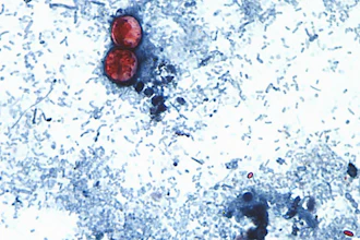 An undated photo taken through a microscope shows Cyclospora cayetanensis oocysts.